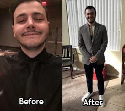 Chanse's Before and After Picture